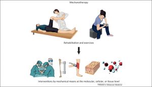 مكانوتراپي (Mechanotherapy)