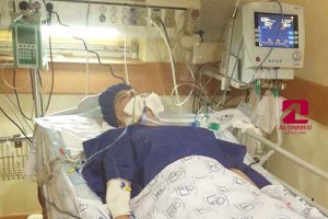نگهداری از بیمار سکته مغزی